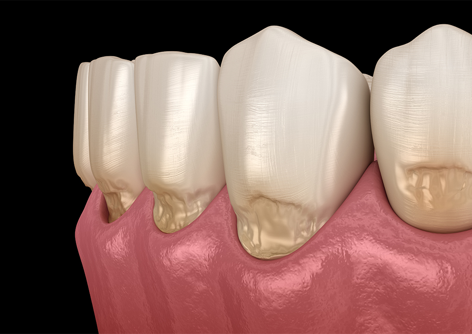 重度の場合の外科的処置