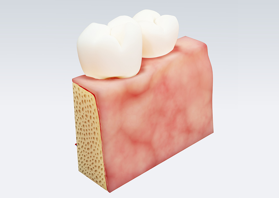 歯周病治療の流れ