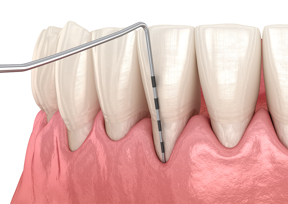 検査とカウンセリング