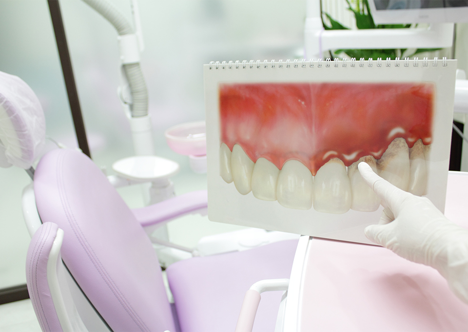 治療とその進め方